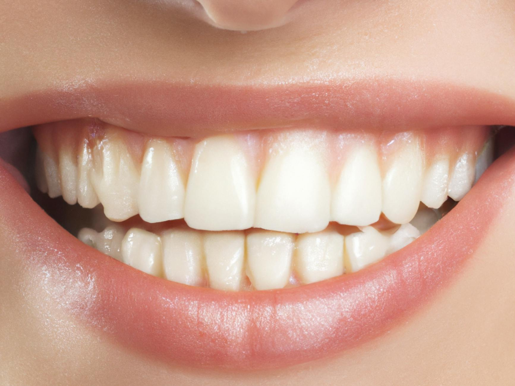 dental treatment costs Switzerland